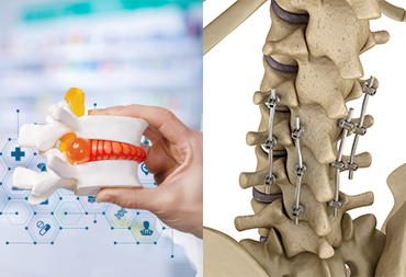 Spine Surgery In Thane